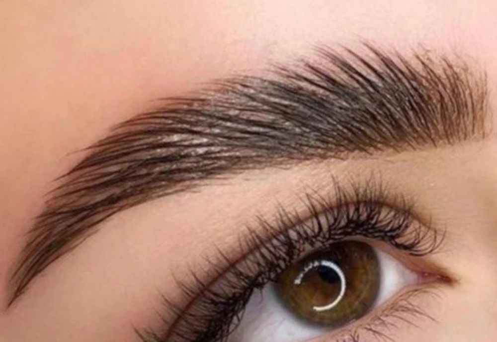 Brow Lifting
